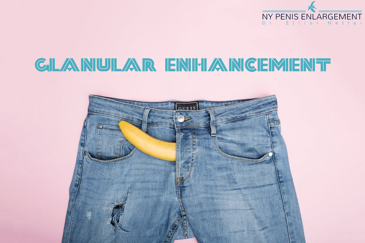 Realce del glande para la cabeza del pene con relleno en Nueva York y Nueva Jersey con el Dr. Elliot Heller