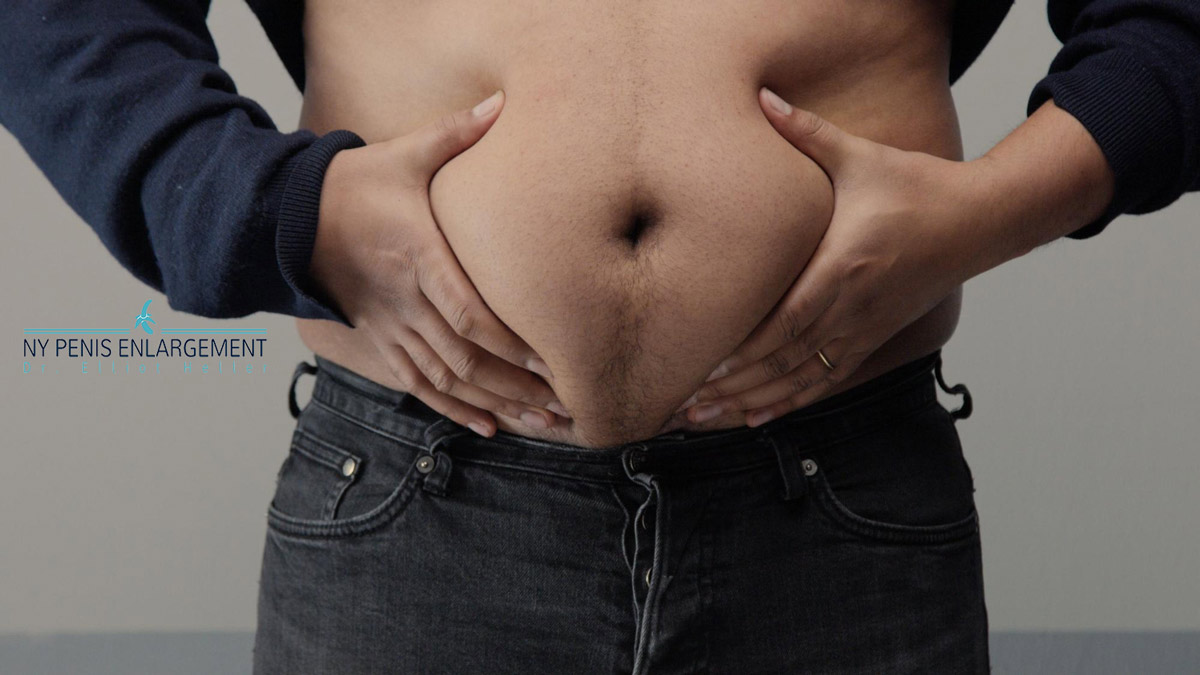 Sagging Skin