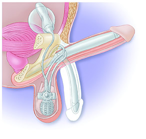 Male Enhancement New York