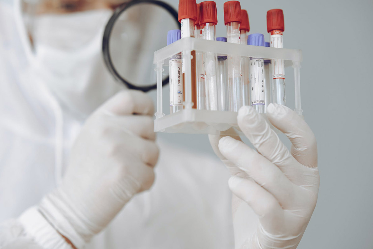 PRP Mixed with Dermal Fillers