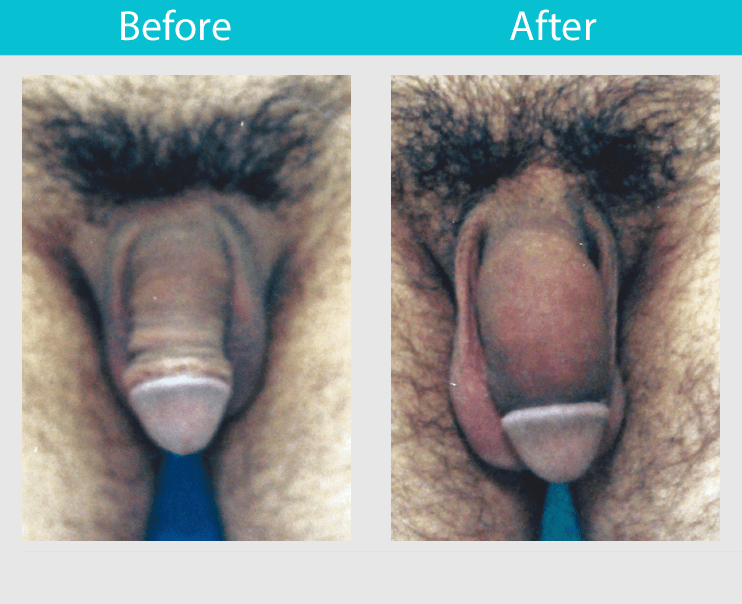 Ebook penis enlargement guide and tips