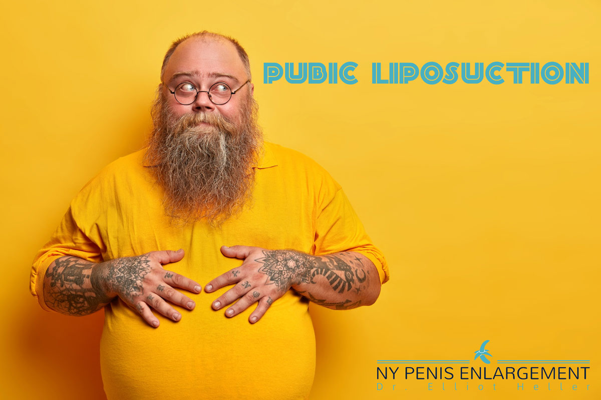 Pubic Liposuction for Penile Enlargement