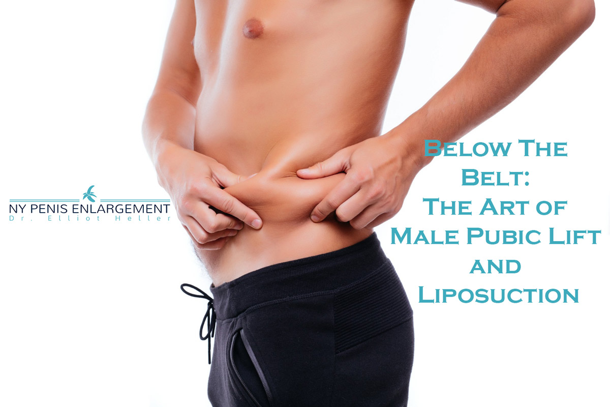 Below The Belt: The Art of Male Pubic Lift and Liposuction 